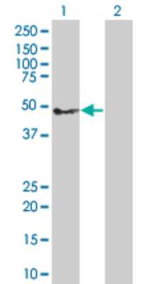 Lane 1: TNFRSF10C transfected lysate (27.4 KDa) Lane 2: Non-transfected lysate.