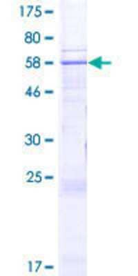 12.5% SDS-PAGE Stained with Coomassie Blue.