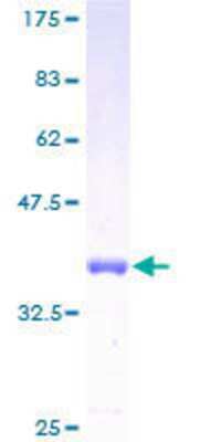 12.5% SDS-PAGE Stained with Coomassie Blue.
