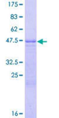 Other Recombinant Human WISP2 GST (N-Term) Protein