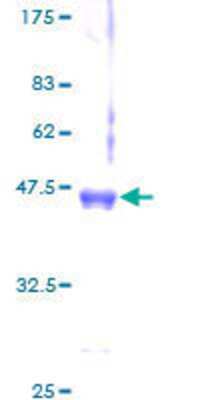 12.5% SDS-PAGE Stained with Coomassie Blue.