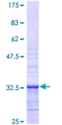 12.5% SDS-PAGE Stained with Coomassie Blue.