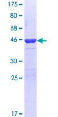 12.5% SDS-PAGE Stained with Coomassie Blue.