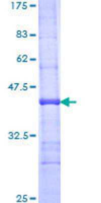 SDS-Page: Recombinant Human SGPL1 Protein [H00008879-Q01] - 12.5% SDS-PAGE Stained with Coomassie Blue.