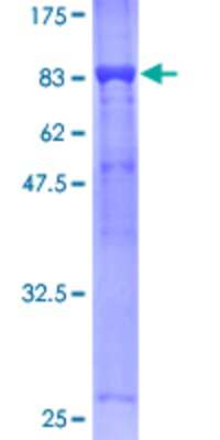 12.5% SDS-PAGE Stained with Coomassie Blue.