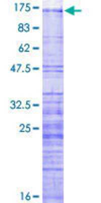 12.5% SDS-PAGE Stained with Coomassie Blue.