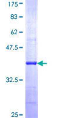 SDS-Page: Recombinant Human AP1G2 Protein [H00008906-Q01] - 12.5% SDS-PAGE Stained with Coomassie Blue.