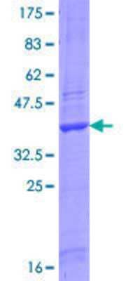 12.5% SDS-PAGE Stained with Coomassie Blue.