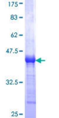 12.5% SDS-PAGE Stained with Coomassie Blue.