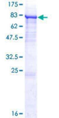 Other Recombinant Human P4HA2 GST (N-Term) Protein