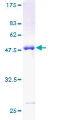 SDS-Page: Recombinant Human CLIC3 Protein [H00009022-P01] - 12.5% SDS-PAGE Stained with Coomassie Blue.