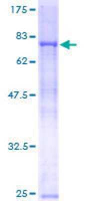 12.5% SDS-PAGE Stained with Coomassie Blue.