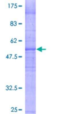 12.5% SDS-PAGE Stained with Coomassie Blue.