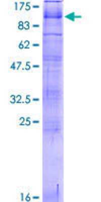 12.5% SDS-PAGE Stained with Coomassie Blue.