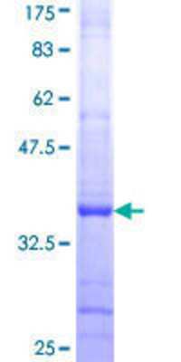 12.5% SDS-PAGE Stained with Coomassie Blue.