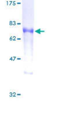 12.5% SDS-PAGE Stained with Coomassie Blue.