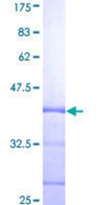 12.5% SDS-PAGE Stained with Coomassie Blue.