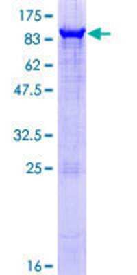 12.5% SDS-PAGE Stained with Coomassie Blue.