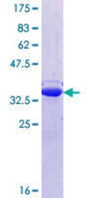 12.5% SDS-PAGE Stained with Coomassie Blue.