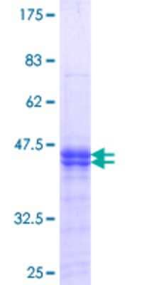 SDS-PAGE Recombinant Human PKMYT1 GST (N-Term) Protein