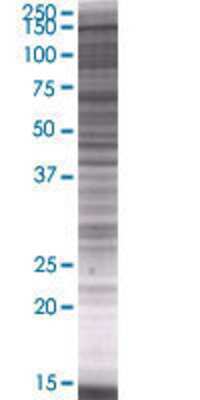 MTMR4 transfected lysate.
