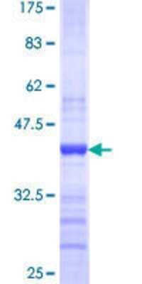 12.5% SDS-PAGE Stained with Coomassie Blue.