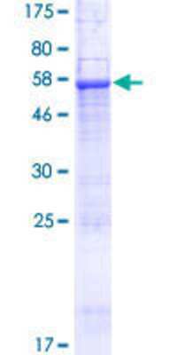 12.5% SDS-PAGE Stained with Coomassie Blue.