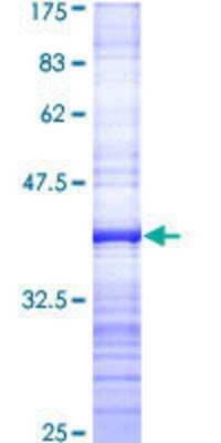 12.5% SDS-PAGE Stained with Coomassie Blue.