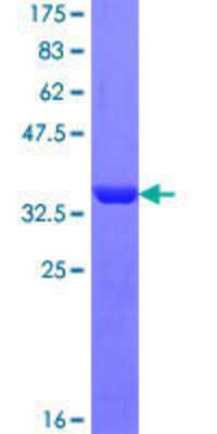 12.5% SDS-PAGE Stained with Coomassie Blue.