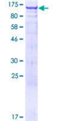 12.5% SDS-PAGE Stained with Coomassie Blue.