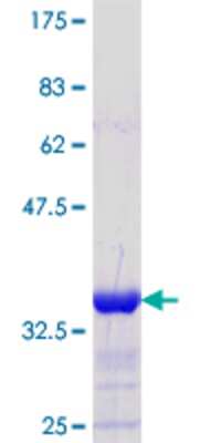 12.5% SDS-PAGE Stained with Coomassie Blue.