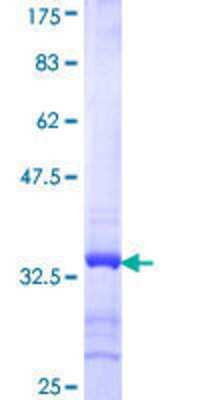 SDS-Page: Recombinant Human Synaptogyrin 2 Protein [H00009144-Q01] - 12.5% SDS-PAGE Stained with Coomassie Blue.