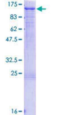 12.5% SDS-PAGE Stained with Coomassie Blue.