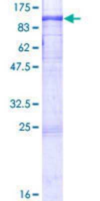 Other Recombinant Human Dyrk1B GST (N-Term) Protein