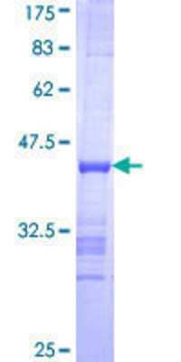 SDS-Page: Recombinant Human Exonuclease 1 Protein [H00009156-Q01] - 12.5% SDS-PAGE Stained with Coomassie Blue.