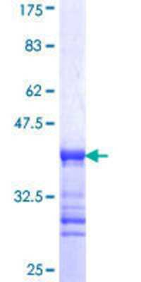 SDS-Page: Recombinant Human REPS2 Protein [H00009185-Q01] - 12.5% SDS-PAGE Stained with Coomassie Blue.