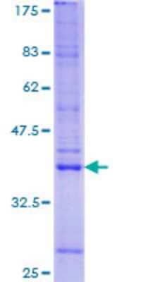 12.5% SDS-PAGE Stained with Coomassie Blue.