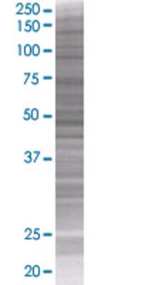 NOLC1 transfected lysate.