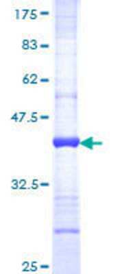 SDS-Page: Recombinant Human Rab11 Protein [H00009230-Q01] - 12.5% SDS-PAGE Stained with Coomassie Blue.