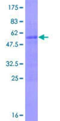 12.5% SDS-PAGE Stained with Coomassie Blue.