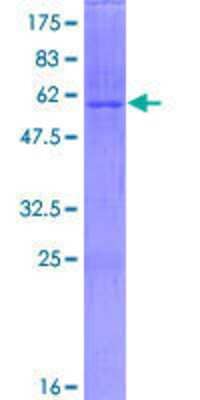 12.5% SDS-PAGE Stained with Coomassie Blue.