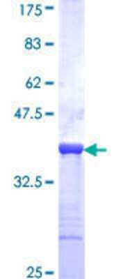 SDS-Page: Recombinant Human CACNA2D2 Protein [H00009254-Q01] - 12.5% SDS-PAGE Stained with Coomassie Blue.