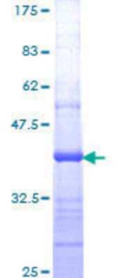 SDS-Page: Recombinant Human ICAP-1 Protein [H00009270-Q01] - 12.5% SDS-PAGE Stained with Coomassie Blue.