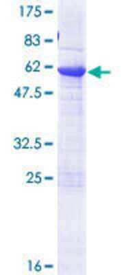 SDS-Page: Recombinant Human BCL7B Protein [H00009275-P01] - 12.5% SDS-PAGE Stained with Coomassie Blue.