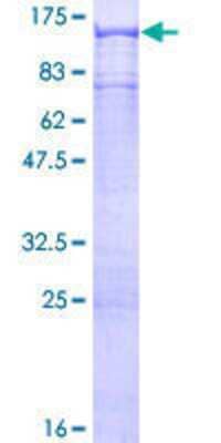 12.5% SDS-PAGE Stained with Coomassie Blue.