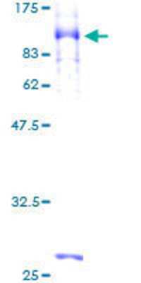 12.5% SDS-PAGE Stained with Coomassie Blue.