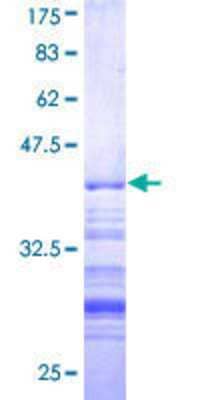 12.5% SDS-PAGE Stained with Coomassie Blue.