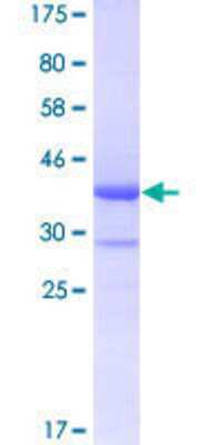 12.5% SDS-PAGE Stained with Coomassie Blue.