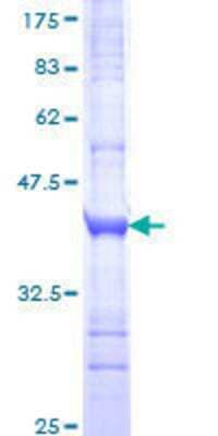 12.5% SDS-PAGE Stained with Coomassie Blue.