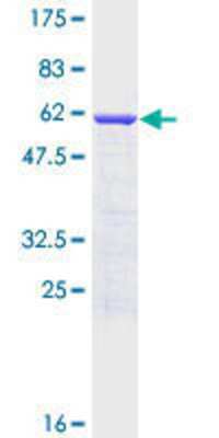 12.5% SDS-PAGE Stained with Coomassie Blue.